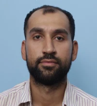 Saransh Choudhary before hair transplant