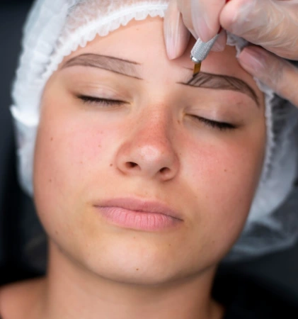 Eyebrow Hair Transplant