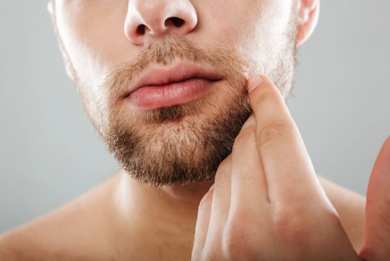 Moustache Hair Transplant in Delhi