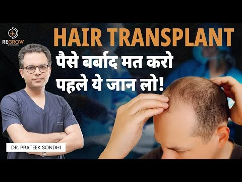 Things to Know Before Hair Transplant | Hair Transplant in Delhi | Dr. Prateek Sondhi