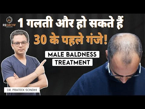 Hair Loss in Men: Causes, Diet, Haircare Routine & Treatments | Male Pattern Baldness |Derma Circles